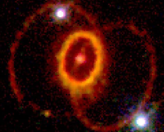 The Mysterious Rings of Supernova 1987A