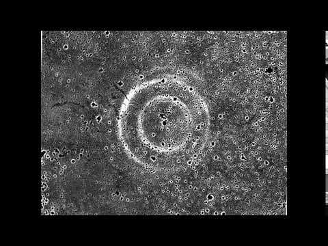 The Expanding Echoes of Supernova 1987A